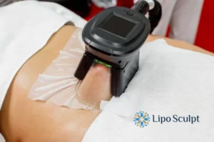 Cryolipolysis Helping You Getting that Perfect Summer Body 3 Cryolipolysis Peterborough can give you the best summer body - contact us today!